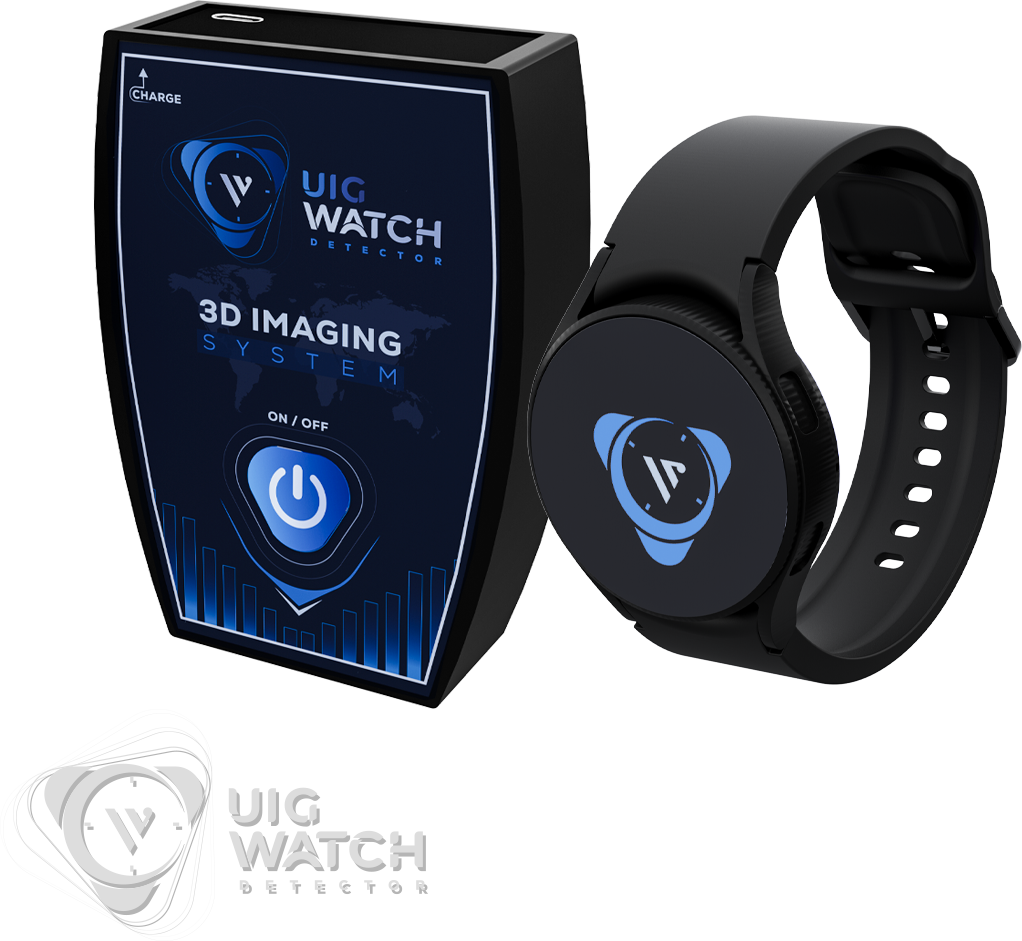 uig watch
